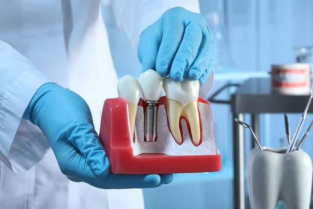 Dental Implants & Oral Surgery